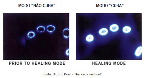 kirlian - estudo 1 - 1