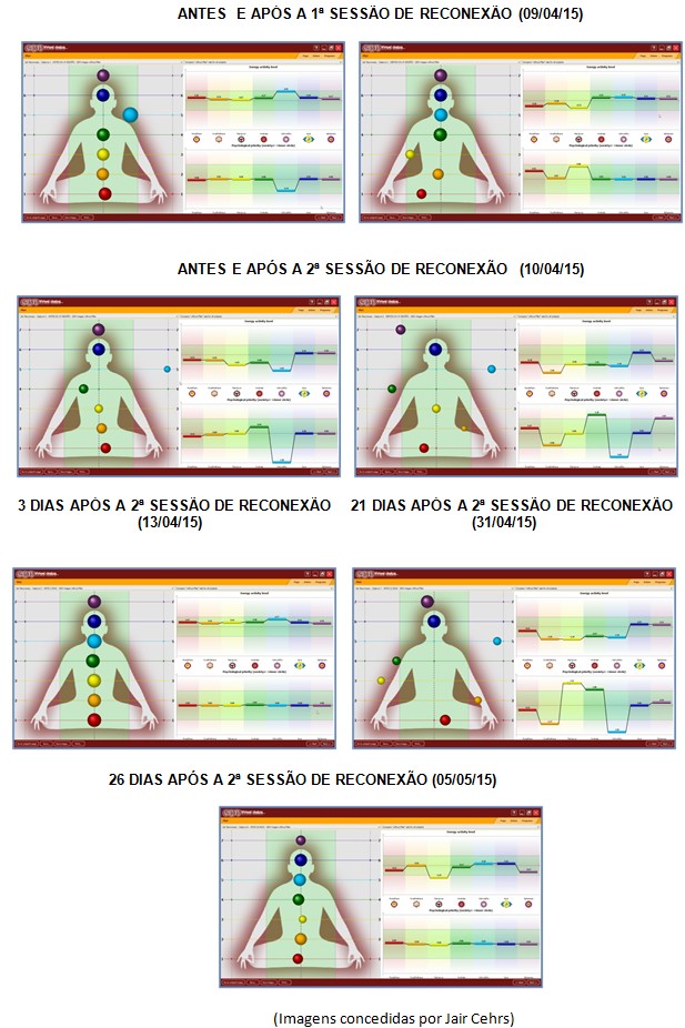 kirlian - estudo 3 - 3